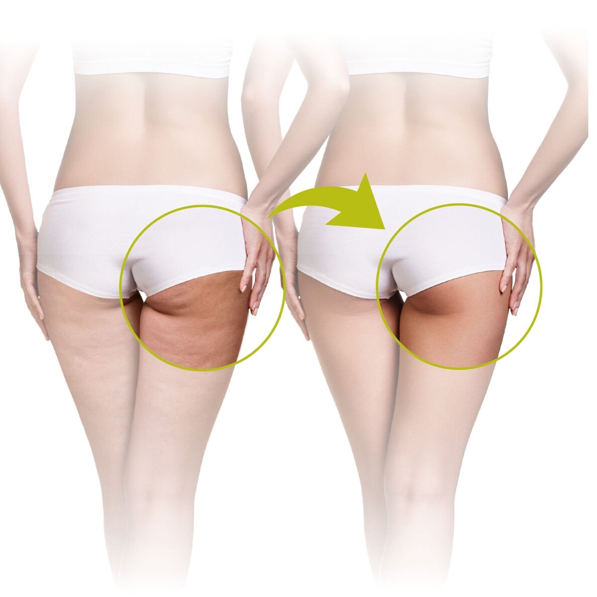 Masażer antycellulitowy Lanaform CELL ROLLER 2 Masażer antycellulitowy Lanaform CELL ROLLER 2