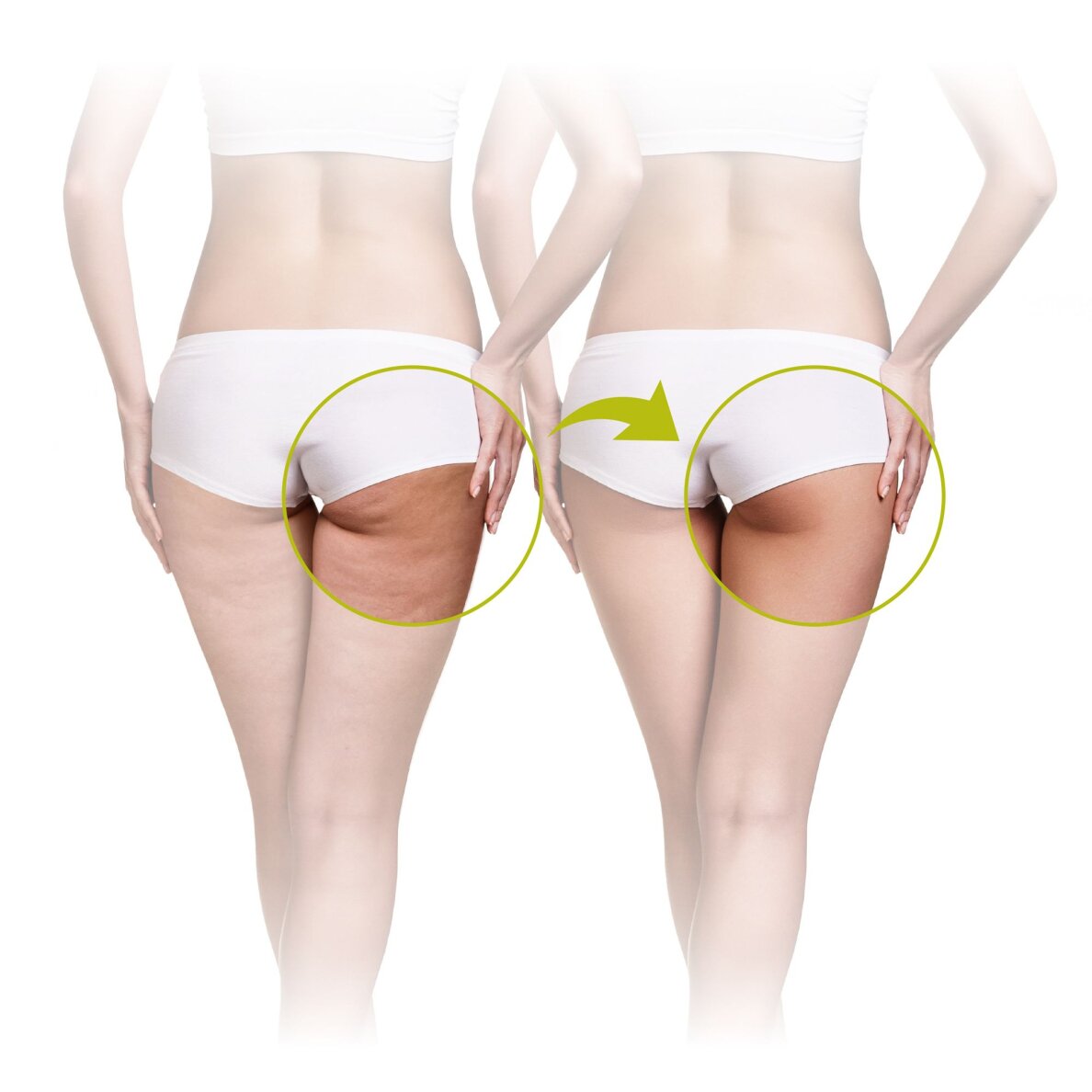 Celulīta masāžas ierīce Lanaform Skin Mass 2 Celulīta masāžas ierīce Lanaform Skin Mass 2