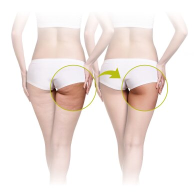 Celulīta masāžas ierīce Lanaform Skin Mass 2