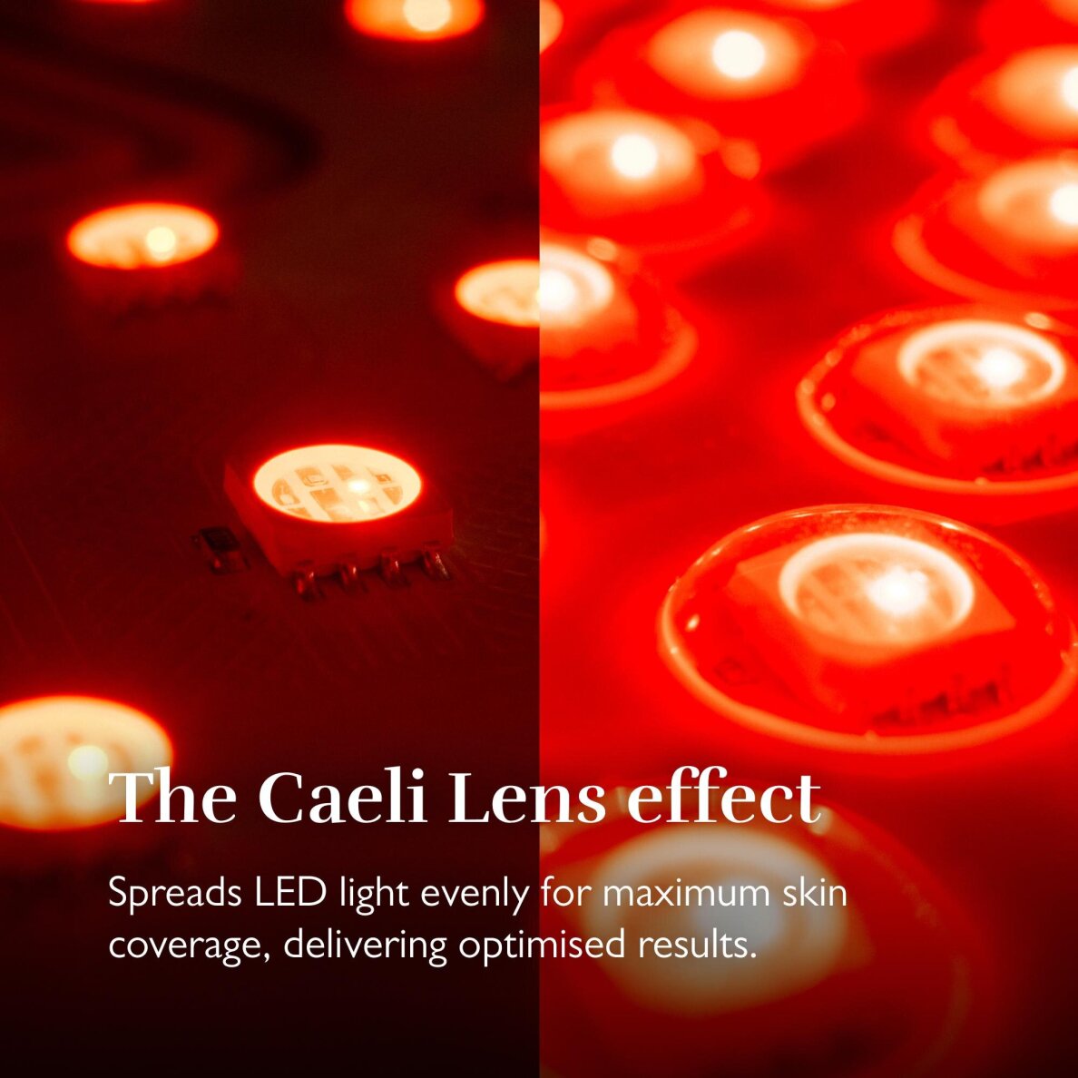 Langaton naamio rintakehän ja kaulan ihon nuorentamiseen Silk'n LED Chest Mask Pro 4 Langaton naamio rintakehän ja kaulan ihon nuorentamiseen Silk'n LED Chest Mask Pro 4