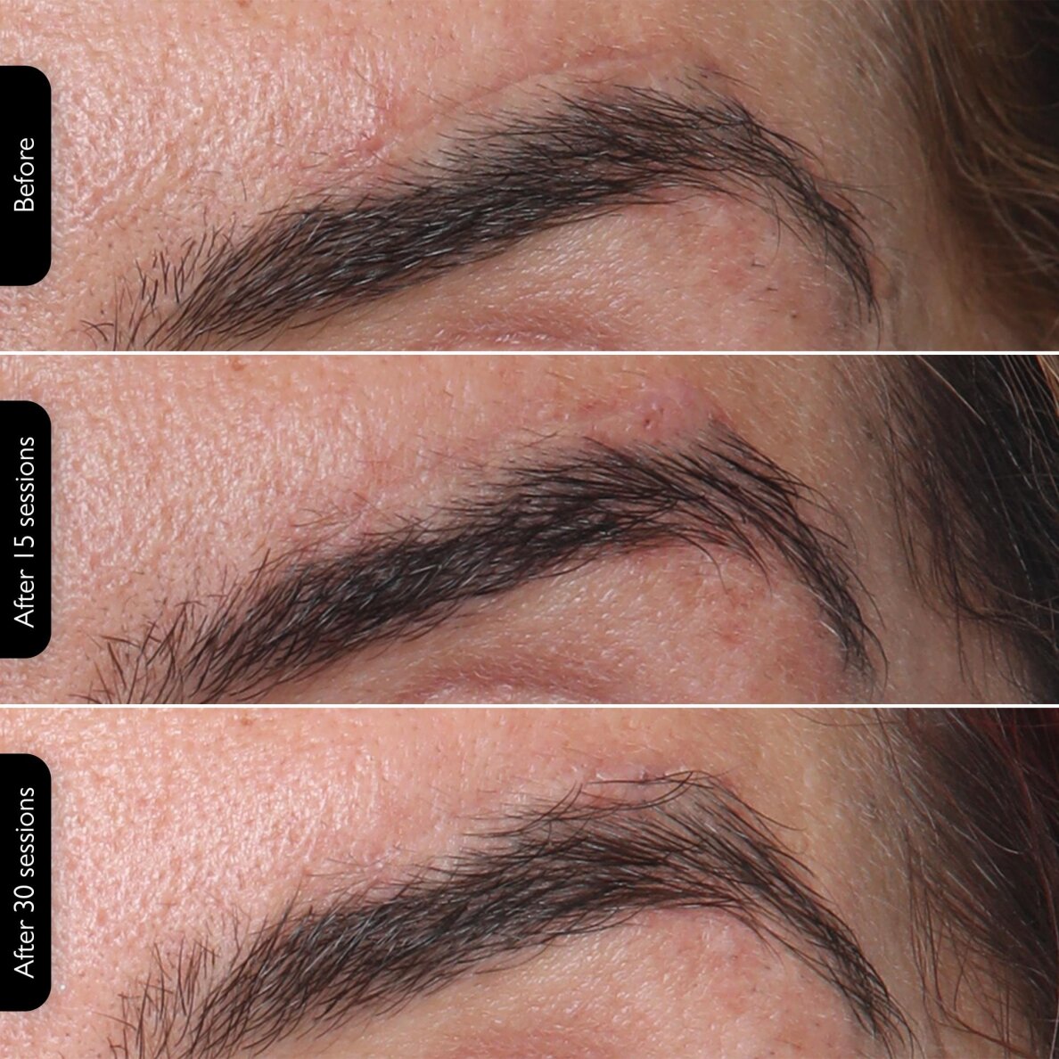 Facial rejuvenating LED mask Silk'n Face Mask 100 9